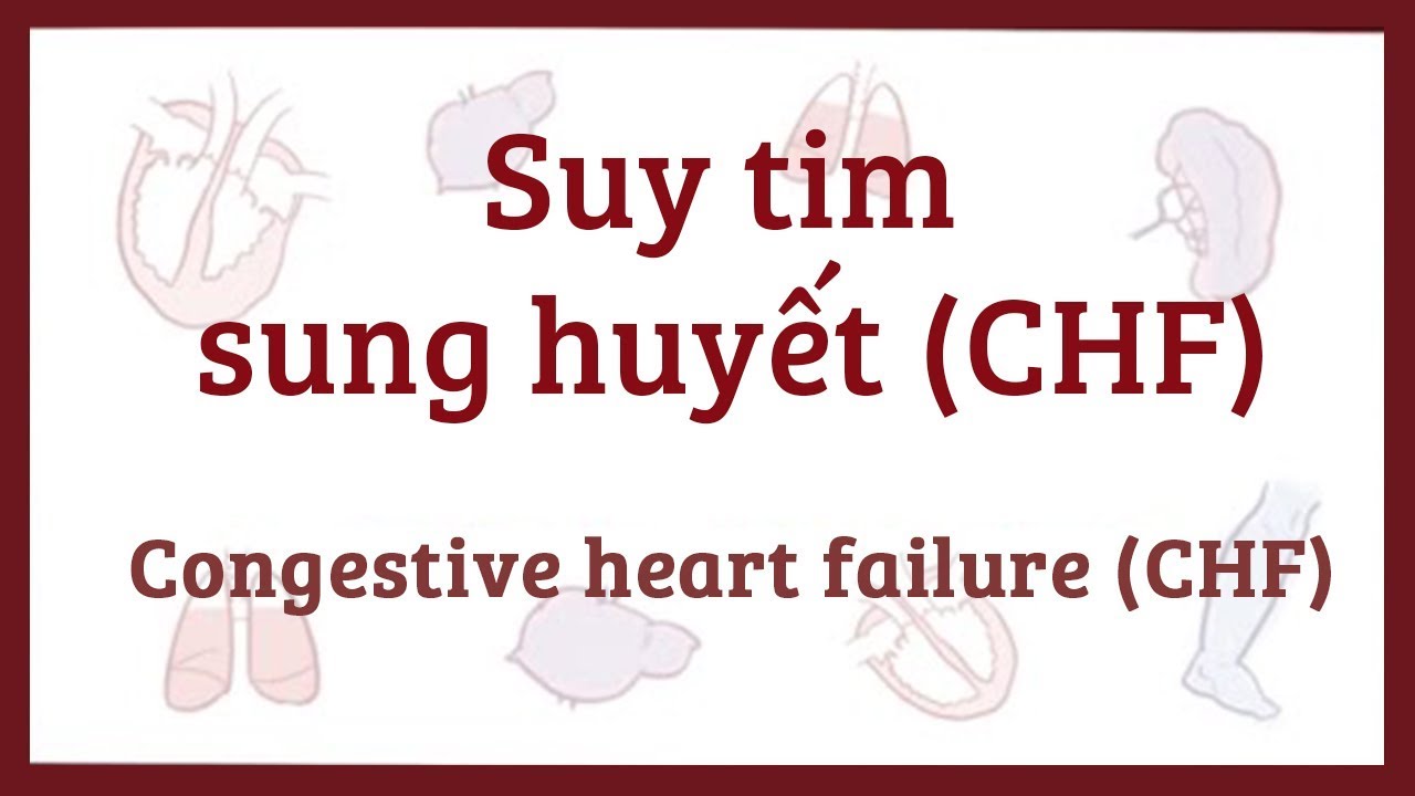 Ảnh 5 của Congestive Cardiac Failure(CHF)